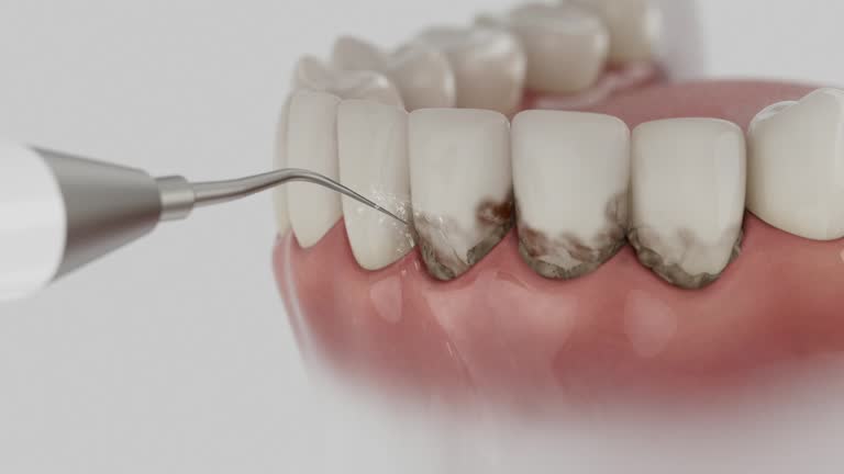 Trusted Root Canal Treatment service in Colfax, IA - Dentist Open Now